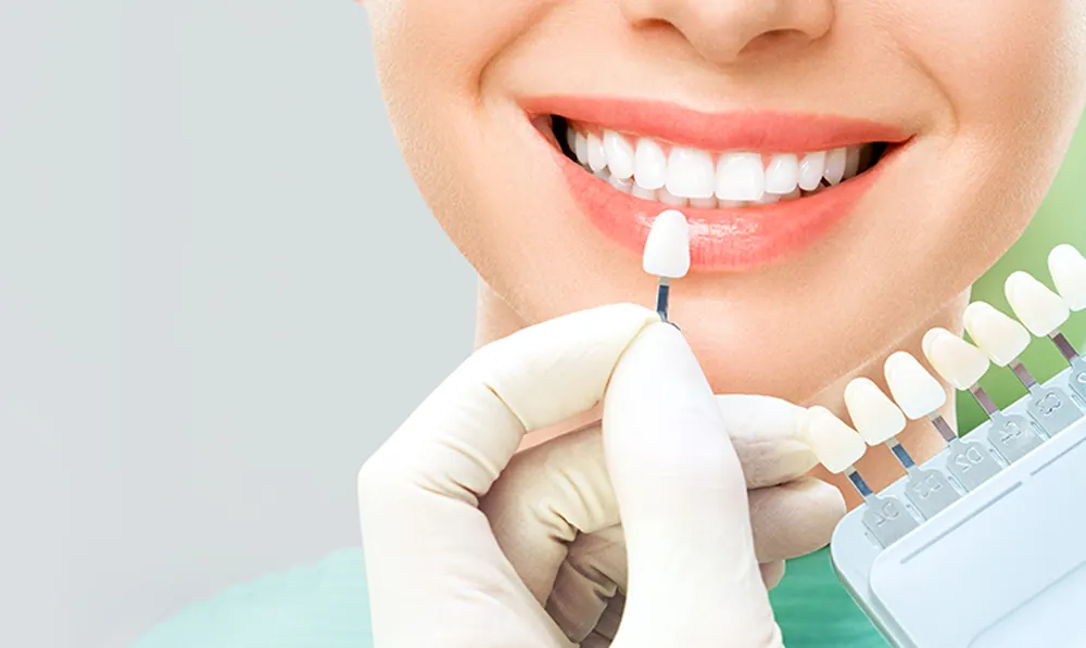 Cosmetic Dentistry at Taylors Rd Dental, Kings Park